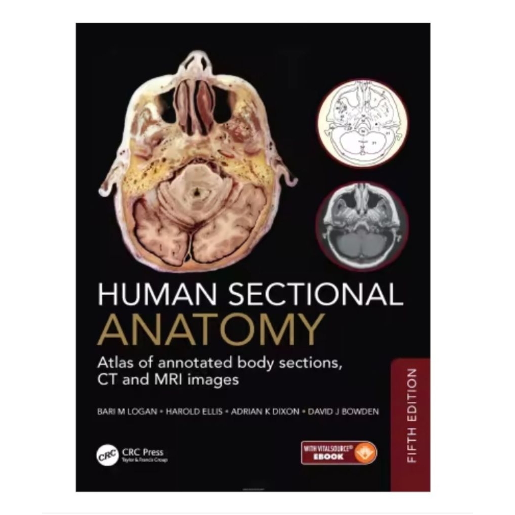 กายวิภาคศาสตร์ส่วนของมนุษย์: Atlas ส่วนของร่างกายที่ไม่ผ่านภาพ CT และ MRI ฉบับ 5