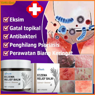 Salep gatal paling ampuh salep eksim cream eksim psoriasis cream ori salep eksim kering salep gatal gatal cream psoriasis Ximonmonth