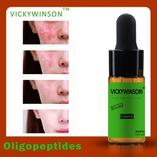 Oligopeptides เซรั่มไวท์เทนนิ่ง กรดไฮยารูลอนิก ให้ความชุ่มชื้น ฟื้นฟูผิวหน้า ขนาด 10 มล.