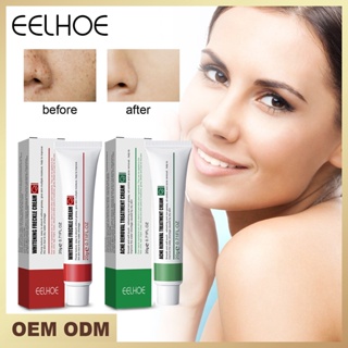 [พร้อมส่ง] Eelhoe EELHOE ครีมกําจัดสิว จุดด่างดํา ปรับสีผิวให้กระจ่างใส ให้ความชุ่มชื้น จุดด่างดํา ครีมซ่อมแซมผิว