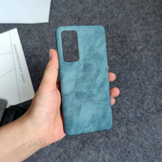 ใหม่ เคสโทรศัพท์มือถือแบบแข็ง ลายแกะ Bapi เรียบง่าย ไฮเอนด์ สําหรับ OnePlus 9pro 9RT 9 1+8T