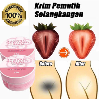 Private Part Inguinal Armpit, Buttock & Elbow Whitening Cream Effective Melanin Removal Skin Tone Brightening