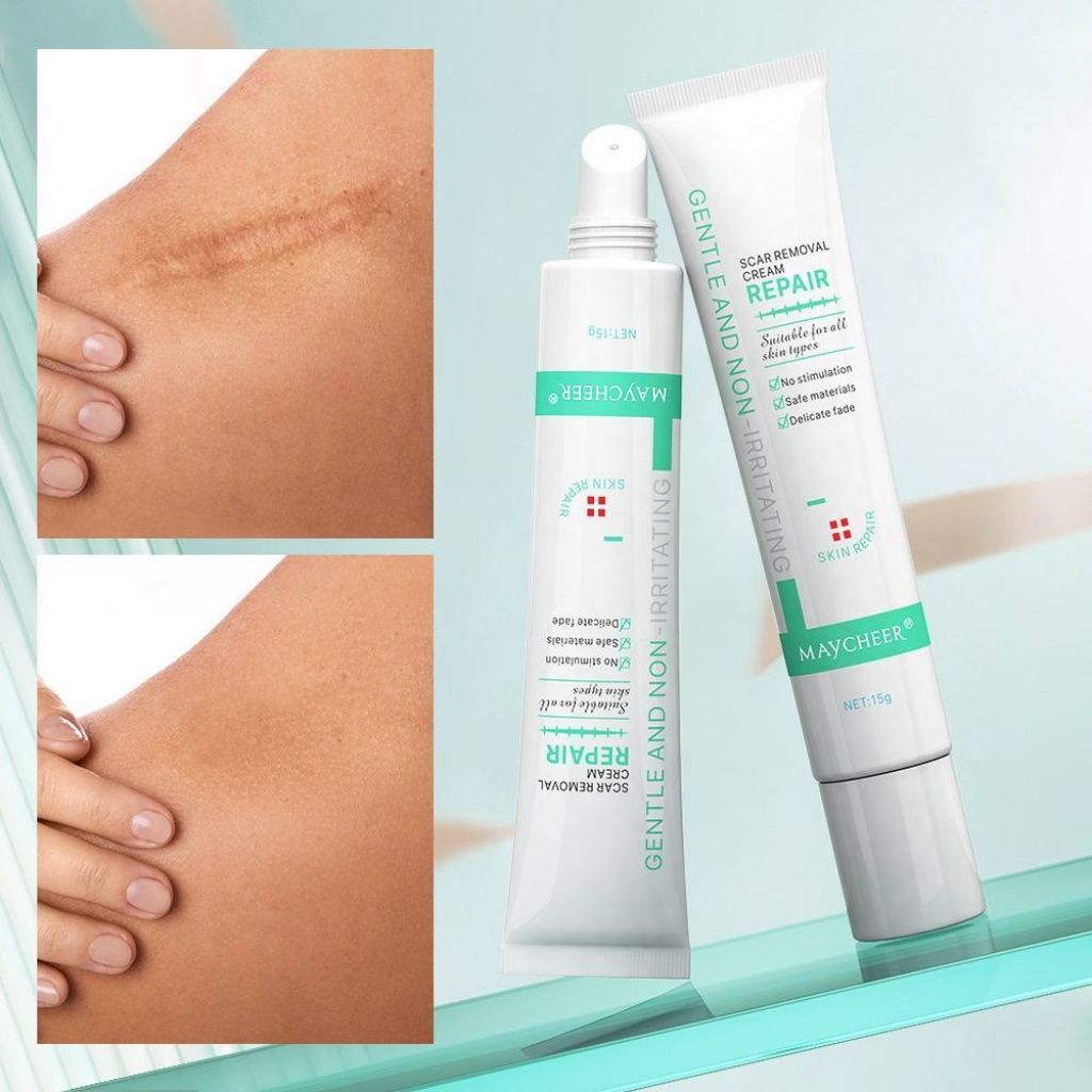 SCAR REMOVAL CREAM REPAIR SCAR REMOVAL CREAM สําหรับรอยแผลเป็นจากสิว รอยดํา ทั้งตัว ลบรอยแผลเป็น