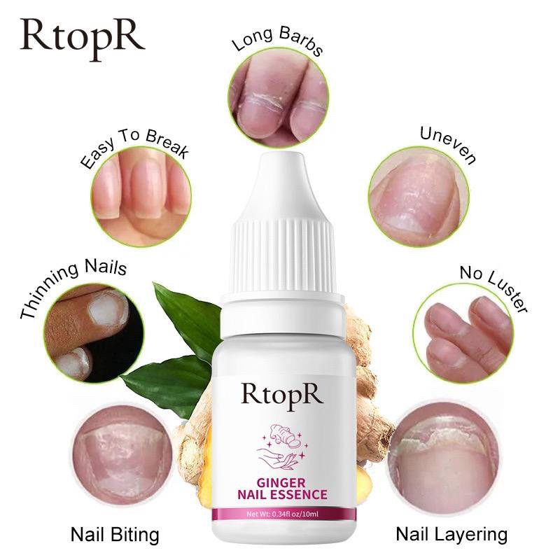 RTOPR GINGER NAIL ESSENCE รักษาเล็บ เล็บสวย ลดความเสียหายเล็บ ซ่อมแซมเล็บ รักษาเล็บ ยาทาเล็บ