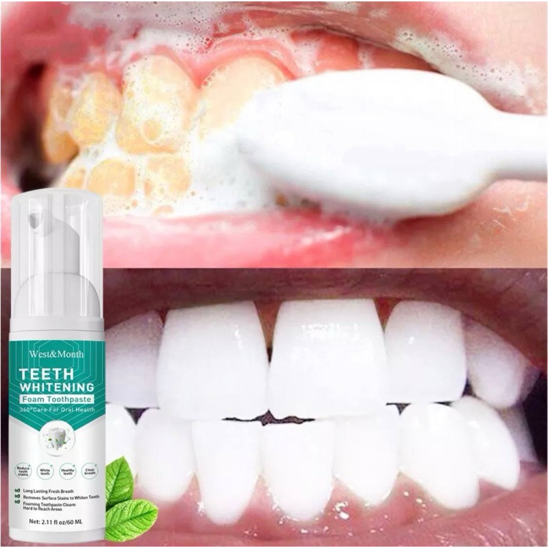 OUHOE TEETH WHITENING ยาสีฟัน TEETH WHITENING ทําความสะอาด TEETH สนิม TEETH ฟอกสีฟันเหลือง TEETH ขจั