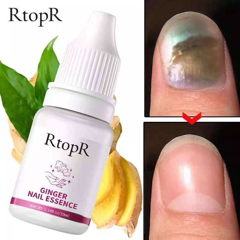 RTOPR GINGER NAIL ESSENCE Pati kuku halia rawatan kuku nail repair baiki kuku rosak kuku hitam kunin