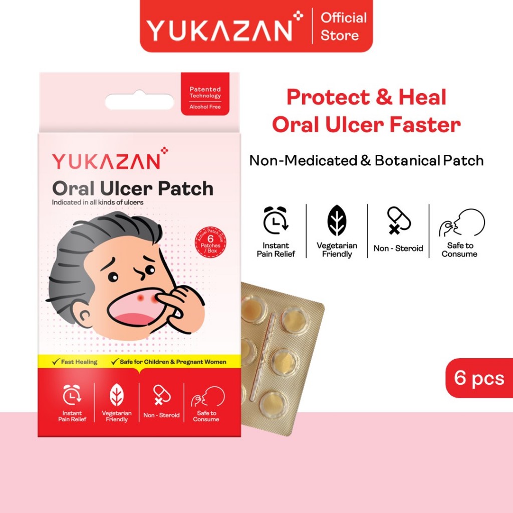 Yukazan Oral Ulcer Patch (6 ชิ้น) - สําหรับแผลในช่องปากและแคนเกอร์ทุกชนิด