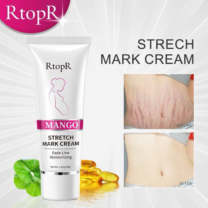 RTOPR MANGO STRETCH MARK CREAM ครีมลบรอยแผลเป็นและรอยแผลเป็นใหม่ช่วยขจัดเส้นสีดํา