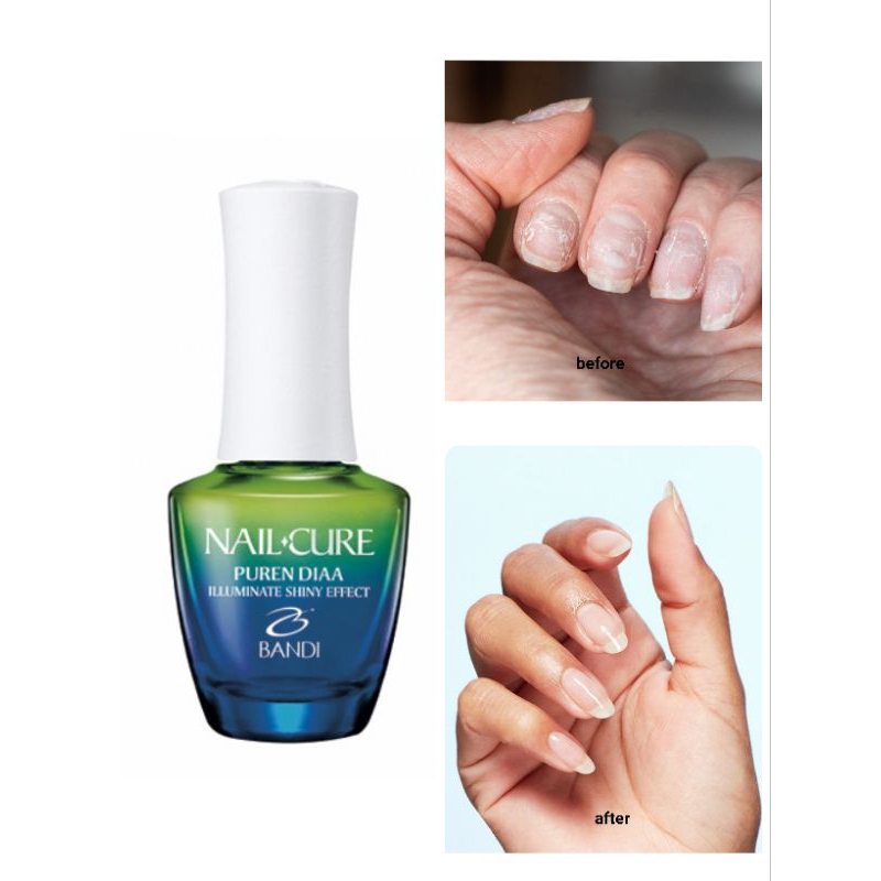 Bandi Nail Cure Pureen Diaa