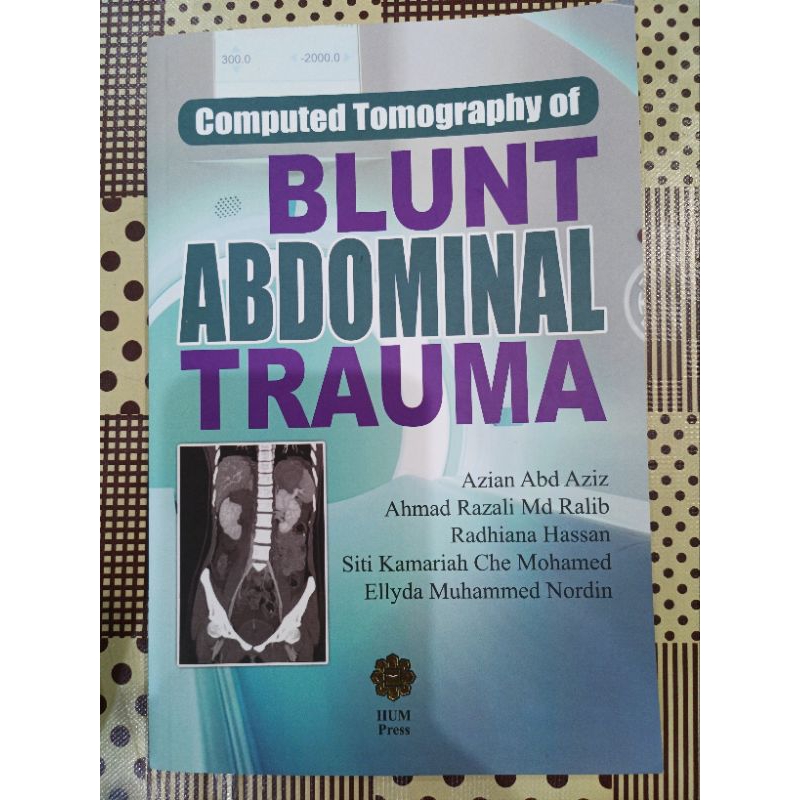 ซบ. Computed Tomography Blunt Trauma ท้อง Azian Abd Aziz, Ahmad Razali Md Ralib, Rutiana Hassan