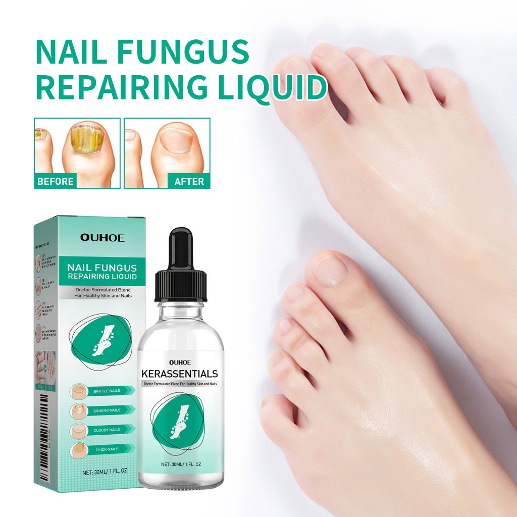 OUHOE Nail Care Liquid 30ml Nail Soft Nail Care ทําความสะอาดทุกวัน Gentle Maintenance Moisturizing B