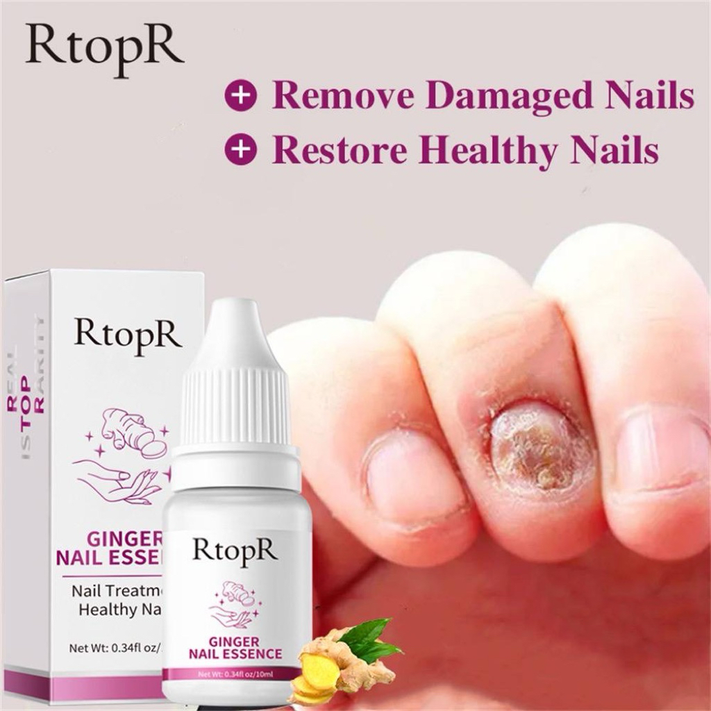 RTOPR GINGER NAIL ESSENCE halia nail ESSENCE รักษาเล็บ น้ํายาล้างเล็บ สีเหลือง สีดํา เชื้อราเล็บหัก