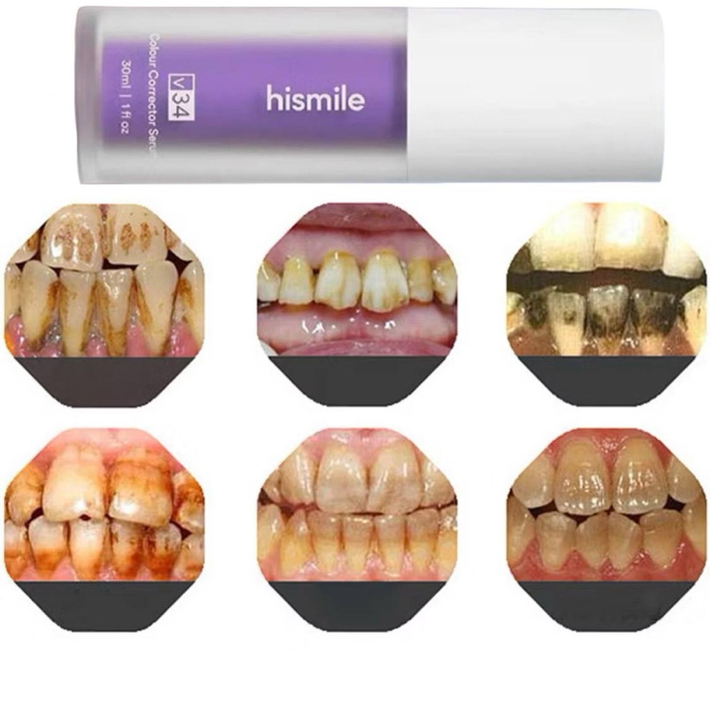 UNGU PURPLE FOAM TEETH WHITENING PURPLE TEETH WHITENING ยาสีฟัน ที่ดีที่สุดและมีประสิทธิภาพที่สุด TE