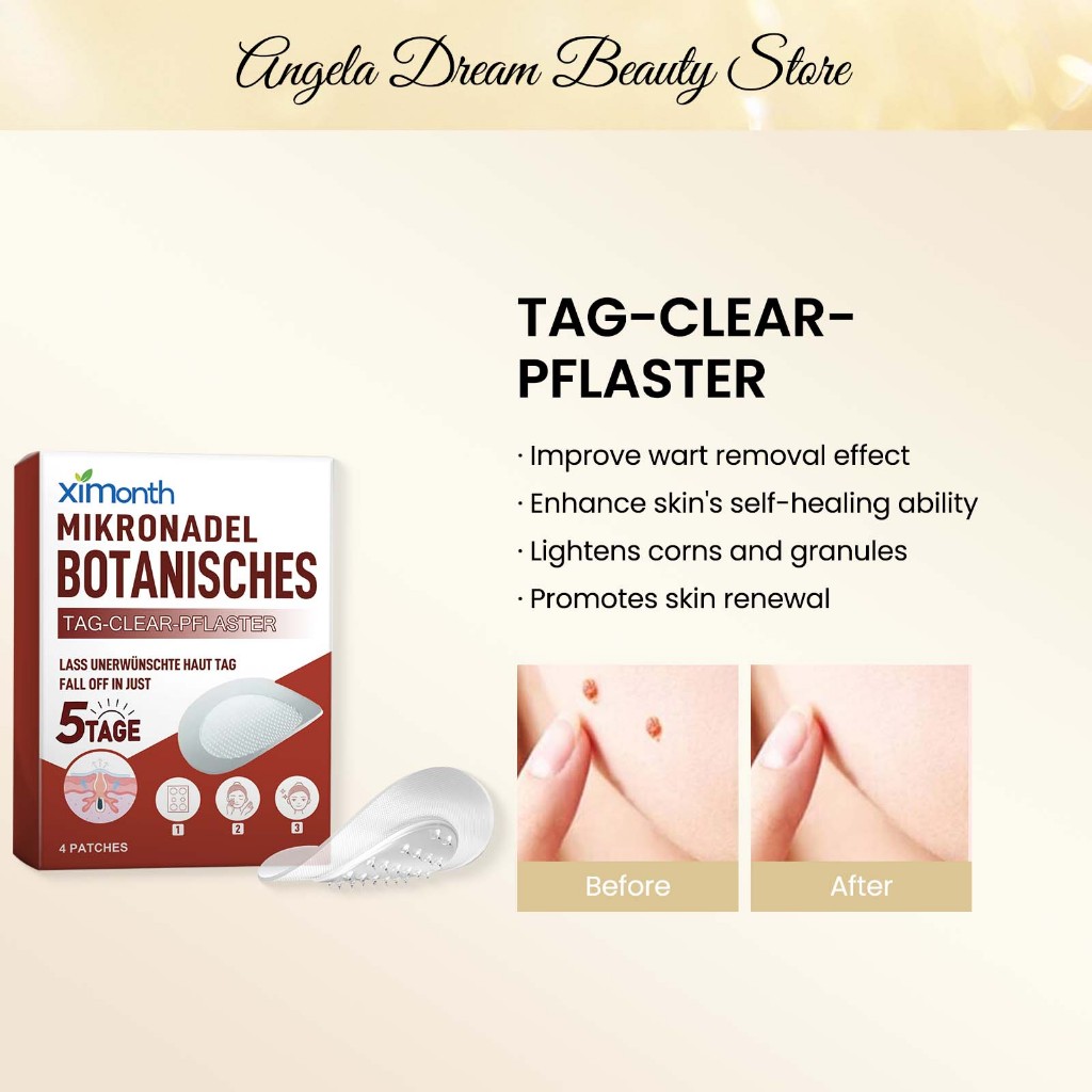 Microneedle Writ removal patch Microdarts สําหรับสิว Microneedle patch Tompok penyingkiran ketuat