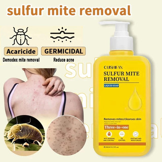 300ML Sulfur Body Wash Removal Cleansing Shower Gel Anti Mite Body Wash Oil Control Acne Removal Eczema Care 硫磺沐浴露