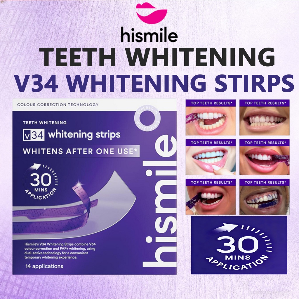 Hismile V34 Whitening Strips, แถบฟอกสีฟัน, ฟอกสีฟันสีม่วง, ทรีทเม้นท์คราบฟัน