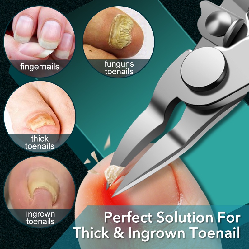 กรรไกรตัดเล็บขบ ใบมีดโค้ง แบบมืออาชีพ สําหรับ Paronychia กรรไกรตัดเล็บ แบบหนา 1 ชิ้น - รูปที่ 2