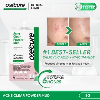 [P99] OXECURE 2% Salicylic Acid Acne Clear Powder Mud 5g