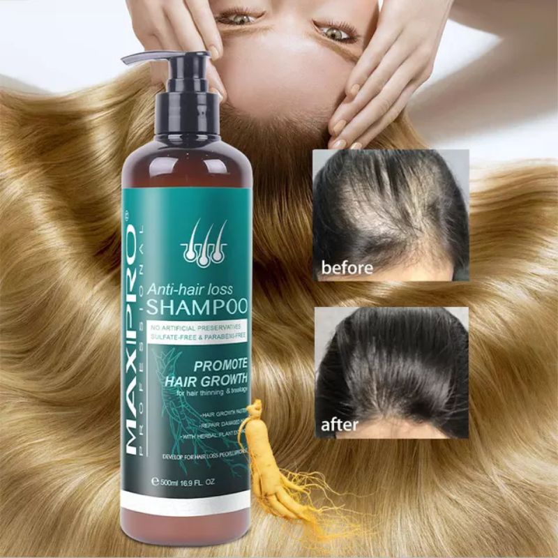 Maxipro Shampoo แชมพูลดอาการคันบนหนังศีรษะ - ppear.co - ThaiPick