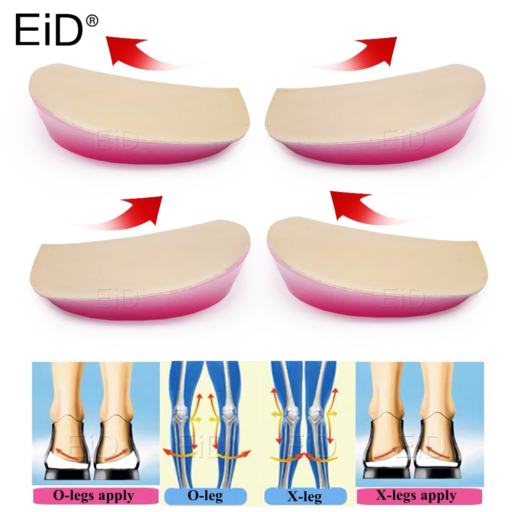 EiD XO ขาซิลิโคนเจลศัลยกรรมกระดูก Insoles สําหรับ Arch สนับสนุน Pad แบนเท้า Orthotic Insert Pain Relief รองเท้าส้นสูงแผ่น Unisex