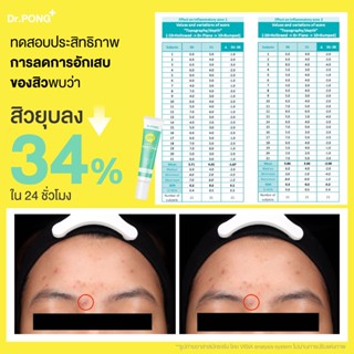 Dr.PONG 28H Whitening drone acne clear spot gel เจลแต้มสิว Niacinamide ZincPCA BHA ทดสอบ clinical efficacy ในคนจริง img 3