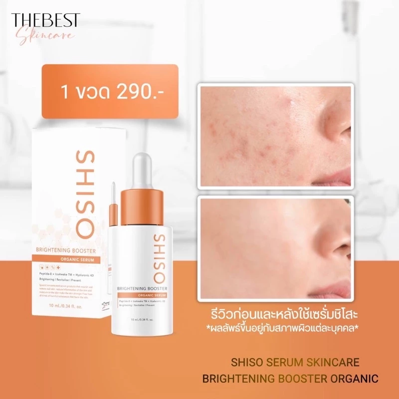 💯ของแท้แพ็คเกจใหม่ ไนท์ครีม The Best 🧡  เดอะ เบส สกินแคร์ [ส่งไว+ส่งฟรี+มีของแถม+มีปลายทาง] ครีมบำรุงผิวหน้า thumbnail 6