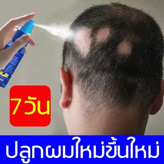 บอกลาหัวล้าน！EELHOE สเปรย์ปลูกผม 30ml ปลูกผม เซรั่มปลูกผม ป้องกันผมร่วง น้ำยาปลูกผม ยาปลูกผมของแท้ สเปรย์ เร่งผมยาว