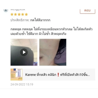 💥ของแถมแน่นมาก💥 ที่กดสิว Karene ส่งตรงจากคลินิก หัวบาง กดง่าย ไม่บาด ใช้จริงในคลินิก