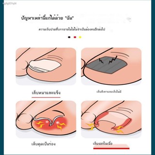 เล็บขบ กรรไกรตัดเล็บขบ ที่ตัดเล็บขบ มีดตัดเล็บขบ ที่แซะเล็บขบ กันไกรตัดเล็บ กรรไกรตัดเล็บ paronychia ชุดกรรไกรตัดเล็บพิเ