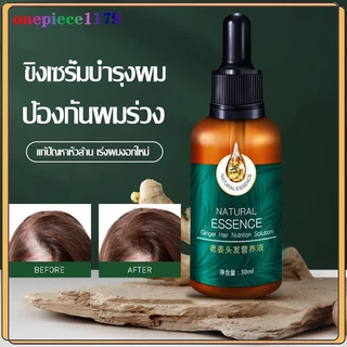 ยาปลูกผมของแท้ น้ำยาเร่งผมยาว เร่งผมยาว น้ำยาปลูกผม เซรั่มปลูกผม ป้องกันผมร่วง บอกลางความบาง บำรุงผม30ml(718)