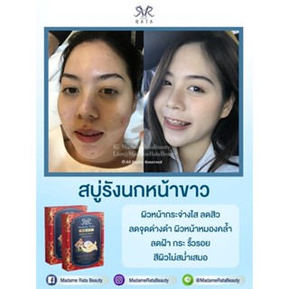 (ขายดี พร้อมส่ง) สบู่รังนก มาดามรัตตะ ลดสิว หน้าเงา สบู่กลูต้า หน้าขาว ใส ลดฝ้าลม แดด กระ จุดด่างดำ รอยสิว ลดสิว