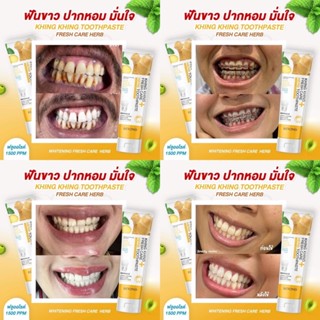 ✱{💐พร้อมส่ง/ 1แถม1} ยาสีฟันขิงขิง ยาสีฟันขิง Beyond ยาสีฟันฟันขาว ฟันขาว ลดกลิ่นปาก ลดหินปูน