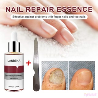 ♕Lanbena Nail Repair Serum การรักษาเชื้อราเล็บลบ Onychomycosis Toe Nourishing Brighten Cracked Damaged เล็บมือเท้า Skin ที่มีประสิทธิภาพ Care