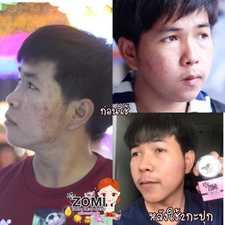 ⦂🐰โซมิ เฟเชียล เคลียร์ ครีม Zomi Cream