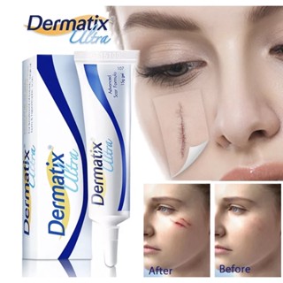 ครีมลบรอยแผลเป็น Dermatix Ultra Gel ของแท้ 100% (จัดส่งในไทย) ลบรอยแผลเป็น ลบรอยแตกลาย ครีมลบรอยแผ