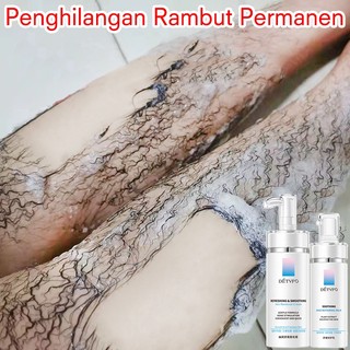 Penghilang bulu permanen ketiak Hair removal cream Underarm Legs Private part Pregnant woman Whole Body Available Painless Hair removal Safety Fast