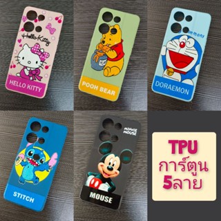 VIVOY20📌TPUนิ่มลายการ์ตูน📌สินค้าพร้อมส่ง✅