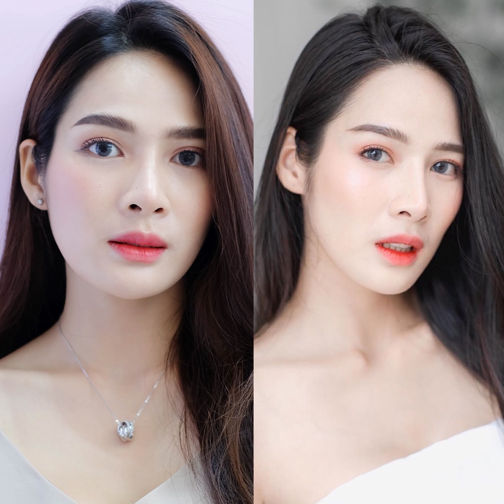 Botox (Nabota) Wrinkles or Jawline or Face Lift / ริ้วรอย หรือ กราม หรือ ลิฟหน้า โบท็อกเกาหลียี้ห้อเดียวที่ได้ US FDA
