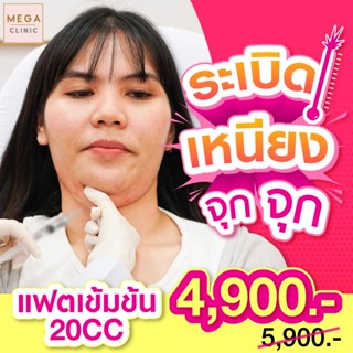 E-voucher Lipo-S แฟตสลายไขมันเข้มข้น 8 เข็ม (20 cc) MEGA CLINIC เมกะคลินิก