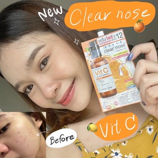 เซรั่มวิตซีเคลียร์โนส Clear Nose Vitamin C Serum สูตรเข้มข้น ผิวกระจ่างใส แบบซอง (1 กล่อง มี 6ซอง)