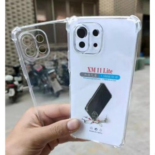 🔥พร้อมส่งใน🇹🇭🔥เคสใสกันกระแทกคลุมกล้อง For Xiaomi Mi11 5G | Xiaomi Mi 11 | XiaomiMi11 / Mi11Lite / Mi 11 Pro / Mi 11 Lite