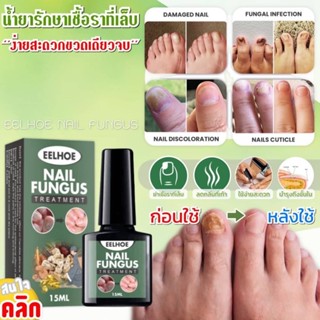 แท้/พร้อมส่ง Eelhoe nail fungus น้ำยาบำรุงเล็บกำจัดเชื้อราที่เล็บ