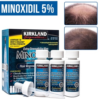 Kirkland Minoxidil 5% สุดคุ้ม{{ ของแท้💯%}} นำเข้าเองขายเอง เคิร์กแลนด์ ไมน็อกซิดิล 5% ดูแลผมร่วง