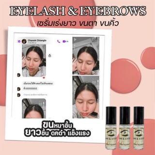 เซรั่มบำรุงขนตา Eyelash &amp; Eyebrows Serum ช่วยให้ขนตายาวหนาดกดำ