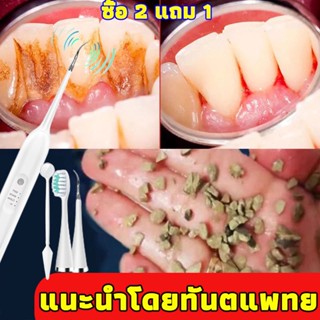 🦷หินปูนไม่มีแล้ว🦷 SUIDDY ที่ขูดหินปูน ล้างสิ่งสกปรกในปาก ไม่ทำร้ายเหงือก ขูดหินปูน เครื่องขูดหินปูน ชุดขูดหินปูน