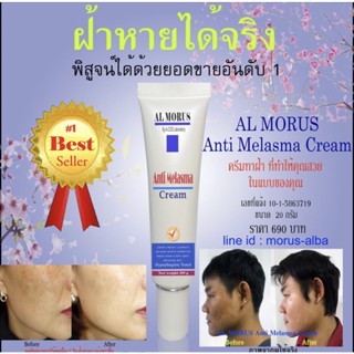 Al morus Anit Melasma Cream ส่งต่อราคาเบาๆ