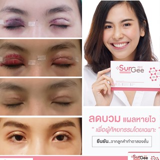 Surgee เซอร์จี้ อาหารเสริมลดบวมช้ำเร่งสมานแผล 1 กล่อง