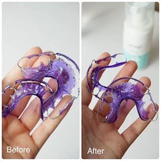 ลด50%ในไลฟ์ 🦷 Remild มูสโฟมรีเทนเนอร์ ฟันปลอม จัดฟันใส aligner/invisalign มูสโฟมทำความสะอาดรีเทนเนอร์ สูตรทันตแพทย์