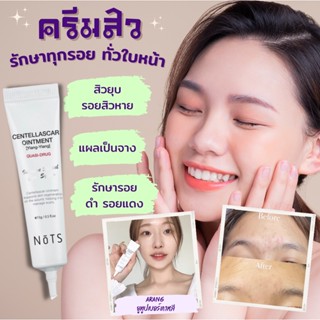 (ส่งฟรี) แต้มสิวตัวดัง ลดแผลและสิวที่กำลังอักเสบ ทำให้สิวจางลง ป้องกันการเกิดสิว NOTS Centella Scar Ointment