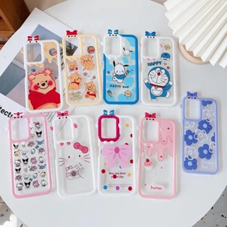 เคสใสการ์ตูนกล้องมีลาย1-Aa A5S A12 F9 A7 A52020 A92020 A15 A16 A54(4G) A16K RENO7Z REN8Z A96(5G) A57(4G) A57(5G) A77(5G)